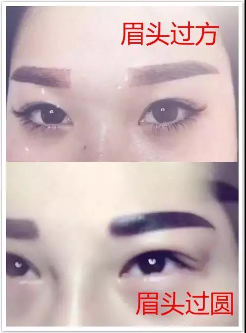 深圳传奇光学科技美容,深圳传奇光学祛斑仪器