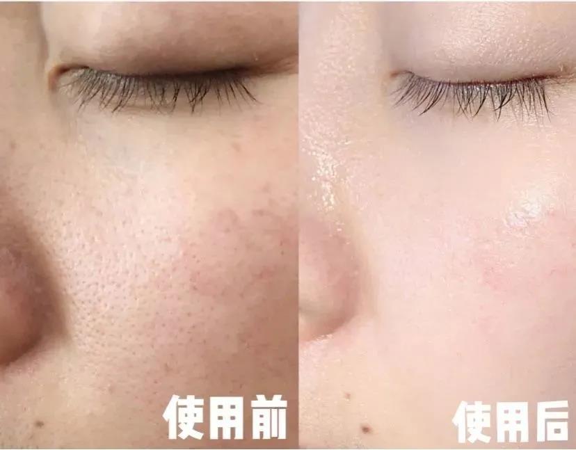 在空调屋里皮肤干燥、瘙痒、泛红，我来帮你解决