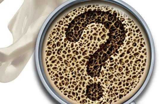 糖尿病和骨质疏松的克星,糖尿病人骨质疏松怎么回事