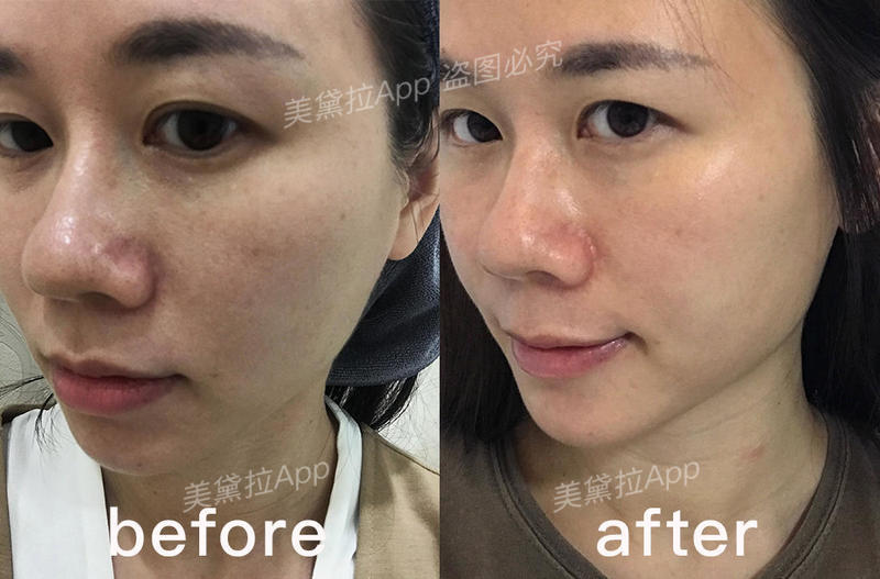 补水保湿美白蛋白精华,美白补水抗皱紧致胶原蛋白