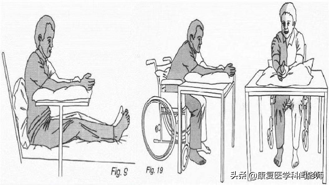 脑卒中后偏瘫患者常见并发症:肩手综合征的康复治疗