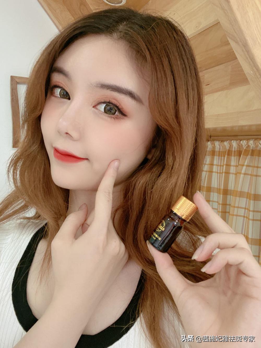 茜施雅妃祛斑最佳方法,茜施雅妃祛斑的方法