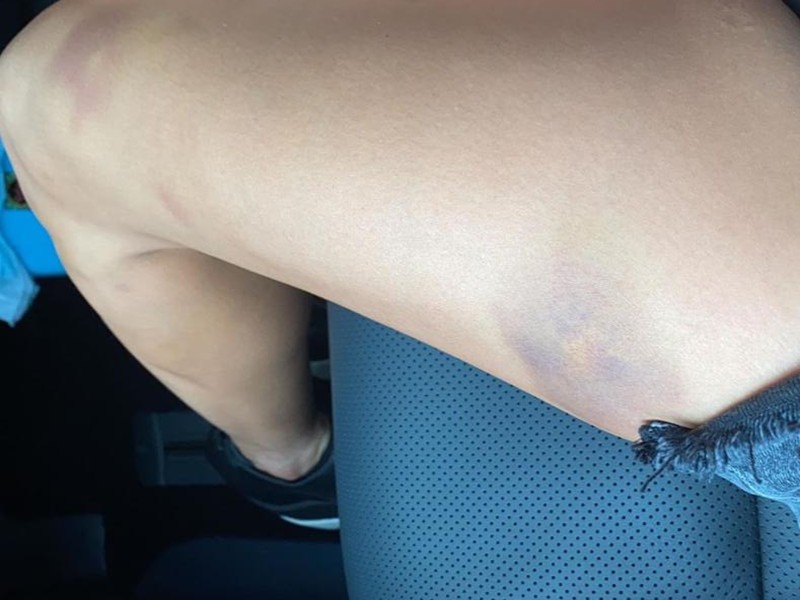 外卖小哥被车撞了后续,被车撞腿外卖小哥后续