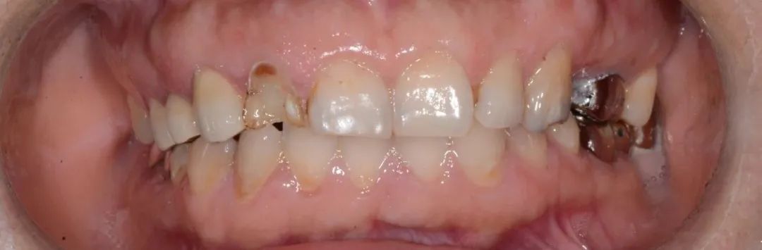 牙医从业感悟,牙医忠告11条