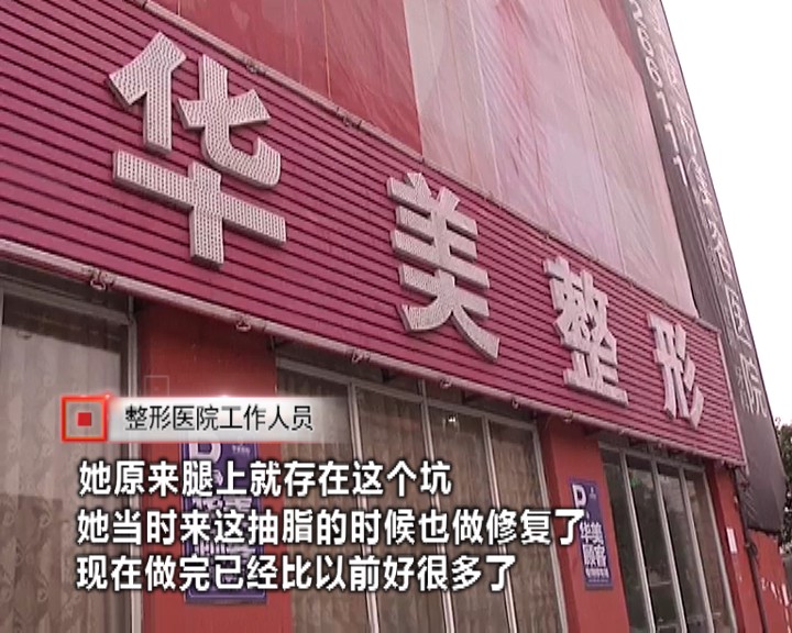 女子花费一万五千元抽脂,女子花三万抽脂术后效果引争议