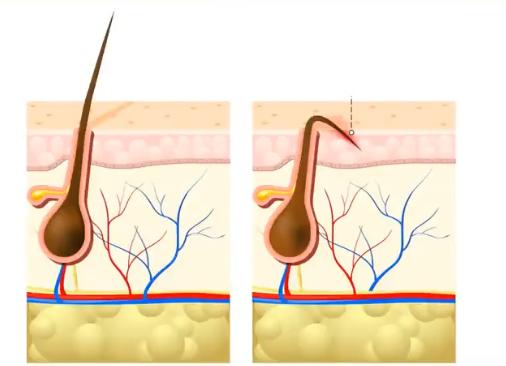 专家告诉你不要经常洗头,长期不洗头掉发还会长出来吗