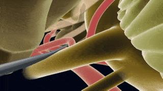 右眼皮一直跳还出车祸了,左眼皮一直跳然后出车祸