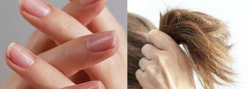 洗脸清洗黑头,洗脸清洁去粉刺