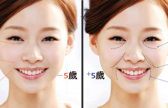 怎么补救法令纹上的细纹,法令纹显老10岁三种方法帮助改善
