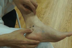 痛经穴位命门,中医调理痛经的穴位