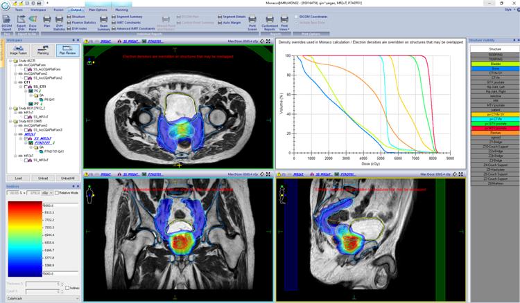 所见即所“治”——西部地区首台核磁加速器投入临床运行