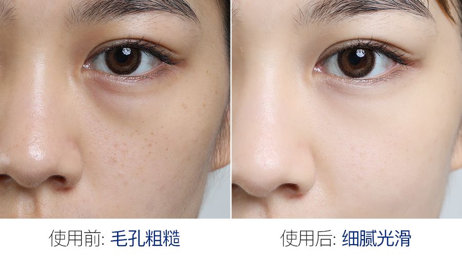 神奇紧致抗皱面膜,神奇面膜一键变老
