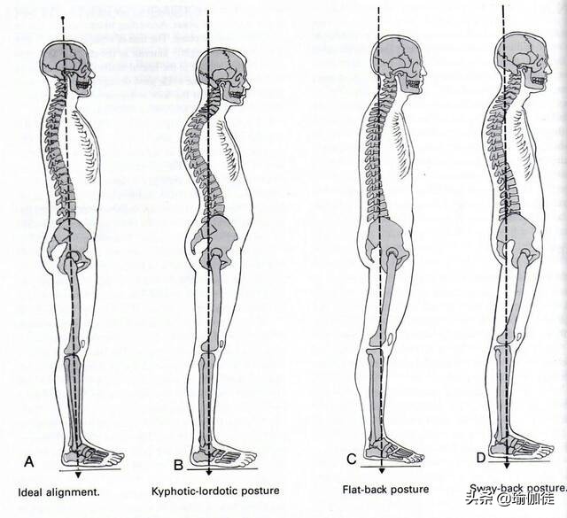 瑜伽山式的九个姿势,瑜伽山式姿势如何做