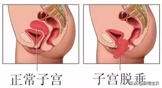 孕妈产后八大疼痛及应对办法!