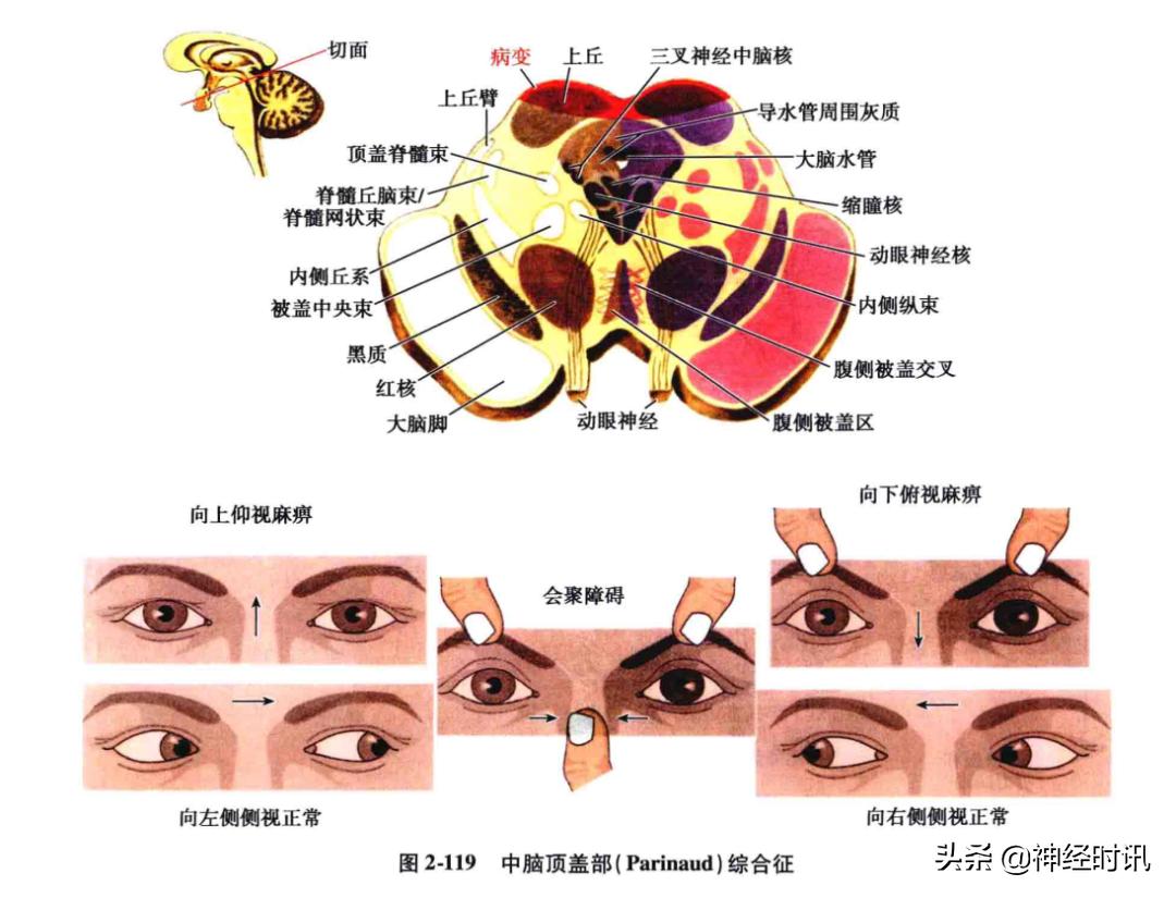 脑干解剖,脑干神经解剖