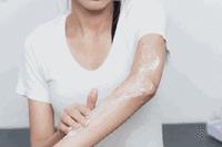 手上皱纹消除最快方法,男士额头皱纹消除最快方法