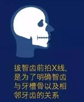 智齿拔除后怎么处理智齿,智齿有必要拔吗智齿痛怎么办