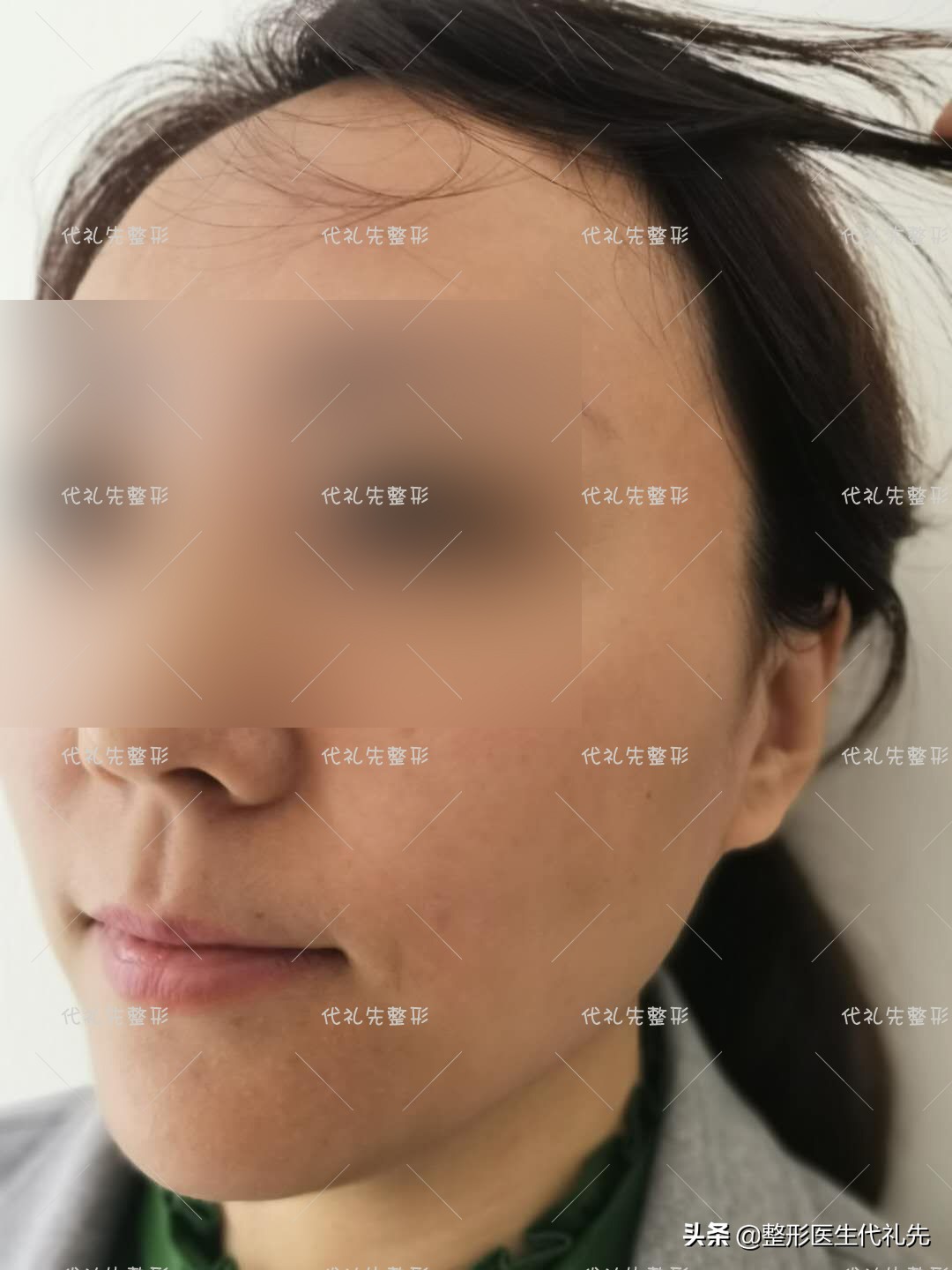 怎样才能拥有完美的下颌线,怎样让自己的下颌线更明显