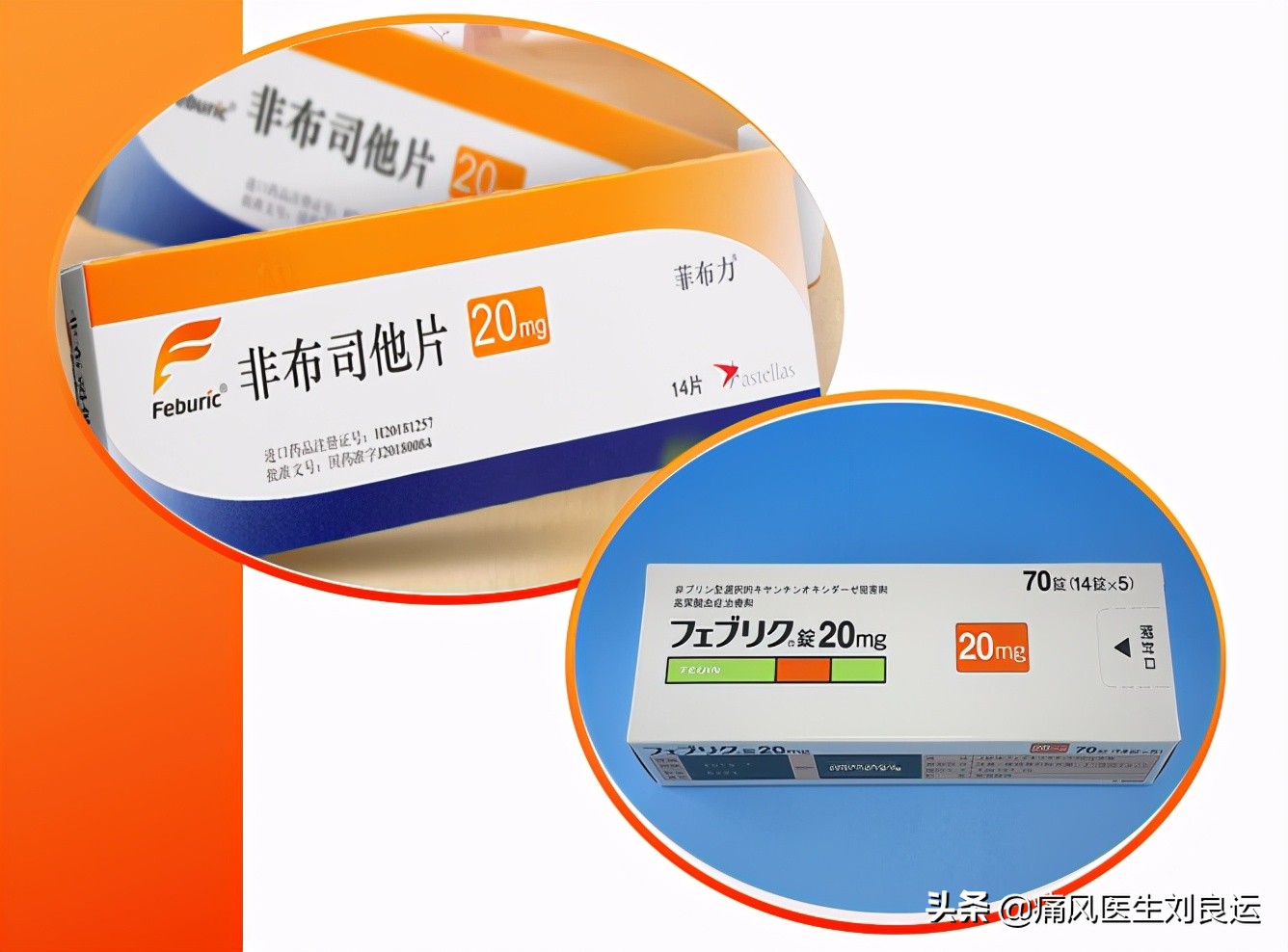 印度进口痛风的药非布司他,日本进口痛风药降尿酸非布司他