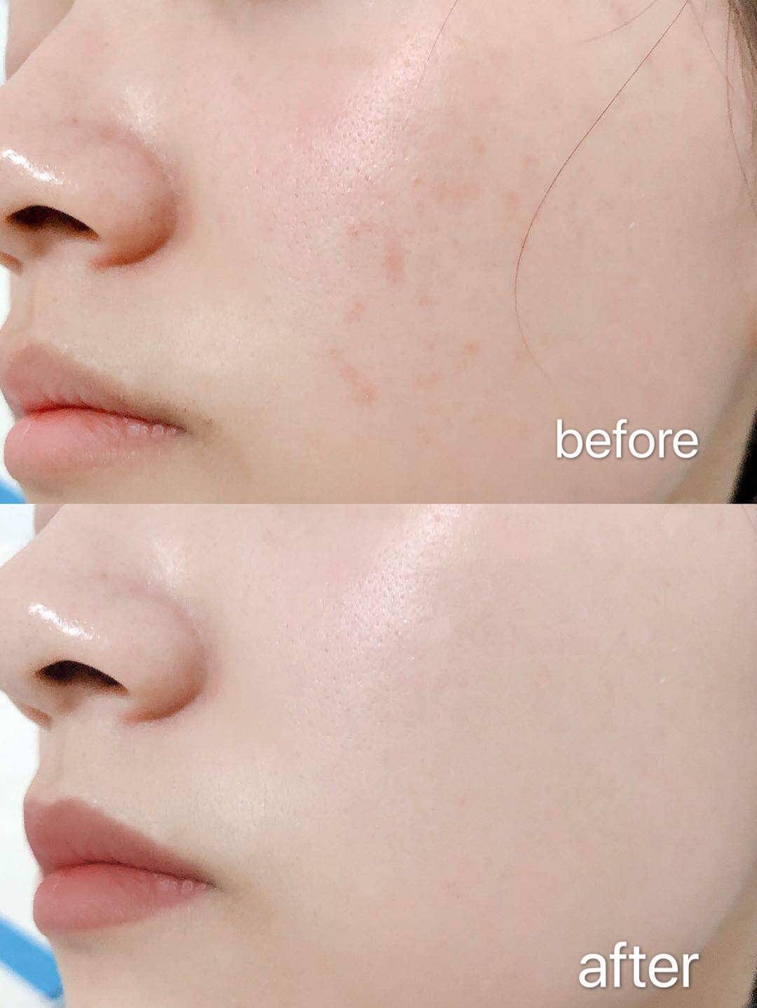 模特人像拍摄方法,模特拍摄前消肿