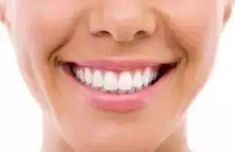 牙齿黑三角要及时修复吗,牙齿黑三角自愈图片