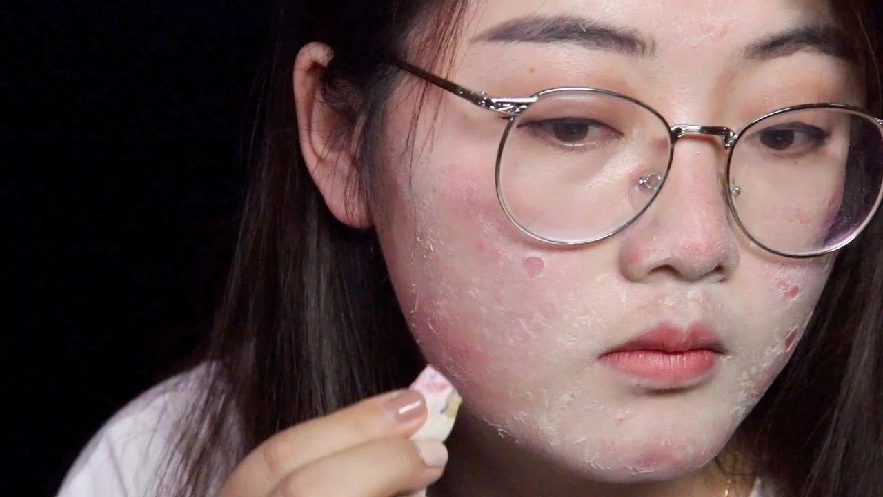 女生最怕“1孔1黑”,特别影响颜值,很多人女生中招还不自知