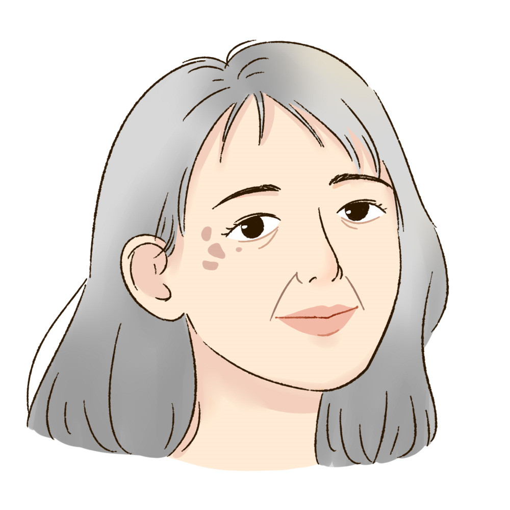 教我们如何淡斑祛斑,如何自己祛斑淡斑