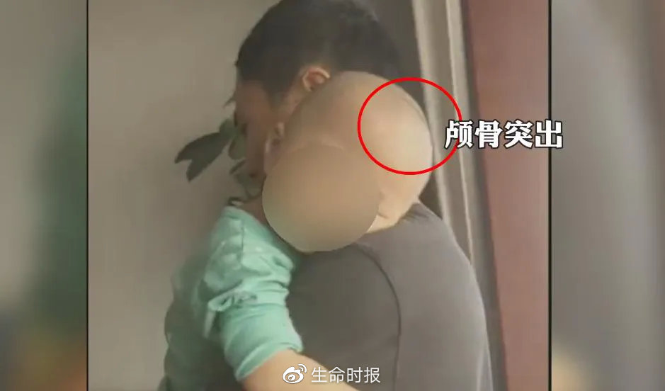 假奶粉喝出的大头娃,假奶粉从包装上能识别出来吗