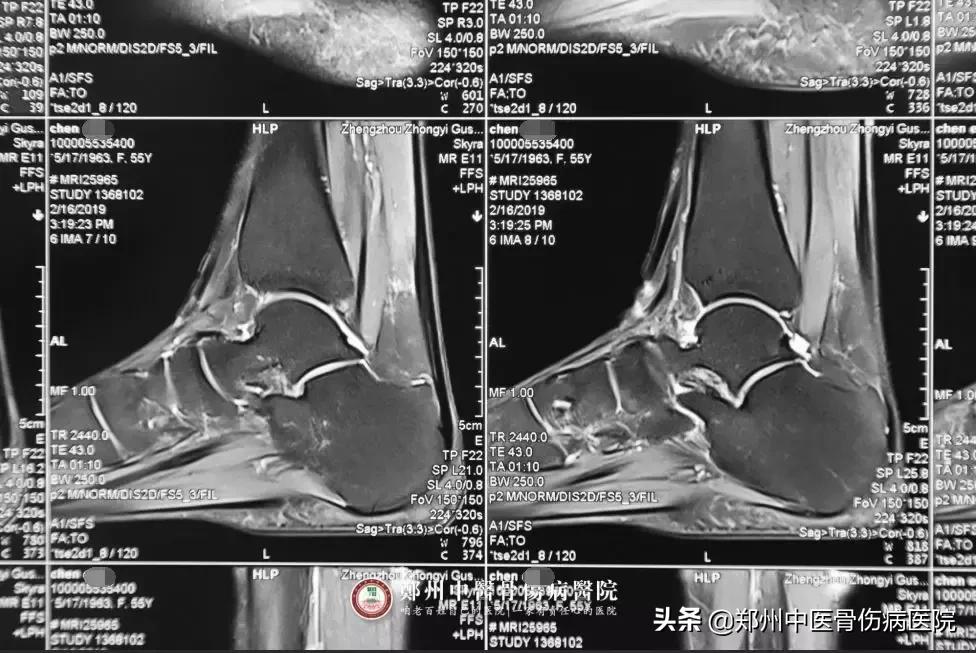 她辗转多家医院治疗未见好转，终在这里成功解除病痛！
