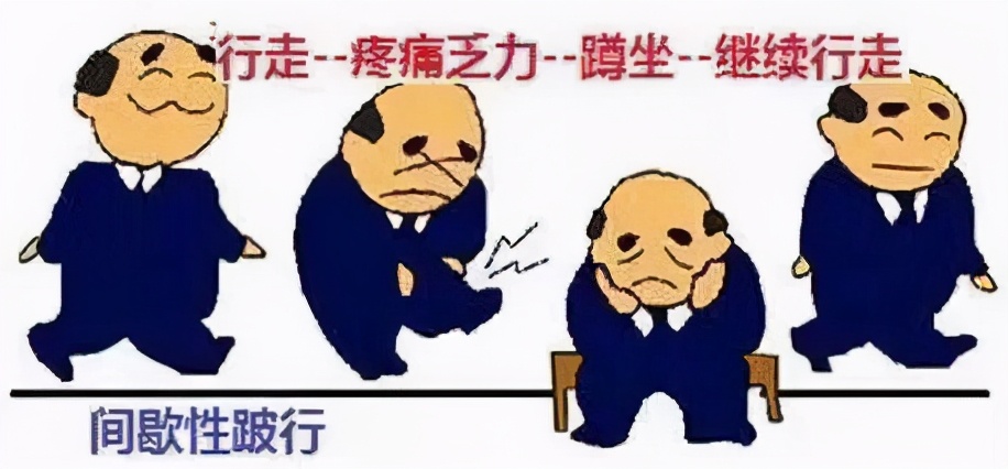 腰椎滑脱症是怎么回事,腰椎滑脱的症状怎么治疗吃啥药