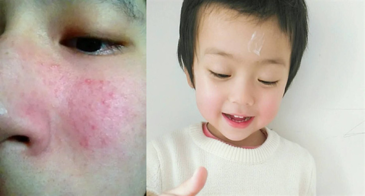 郁美净无硅油儿童面霜,郁美净为什么突然买不到了