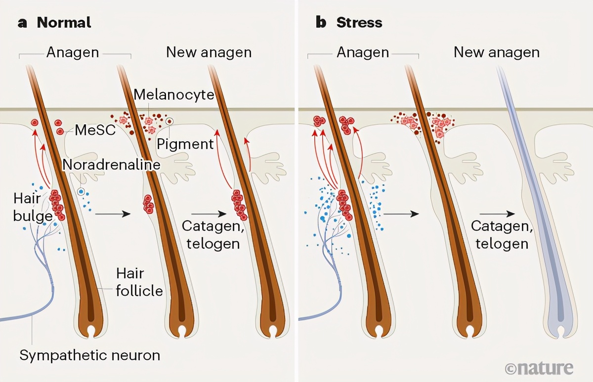 “压力秃”有可能逆转，英国《自然》杂志揭秘毛囊是怎样被压垮的