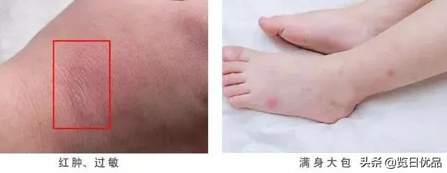 vape驱蚊喷雾驱蚊水 (vape驱蚊水哪个颜色驱蚊效果好)