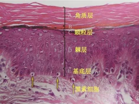 皮肤科医生建议刷酸,皮肤科医生刷酸详细步骤