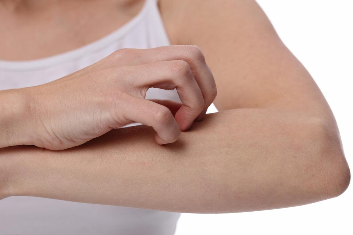 过敏越来越多谁之过,过敏背后的真相