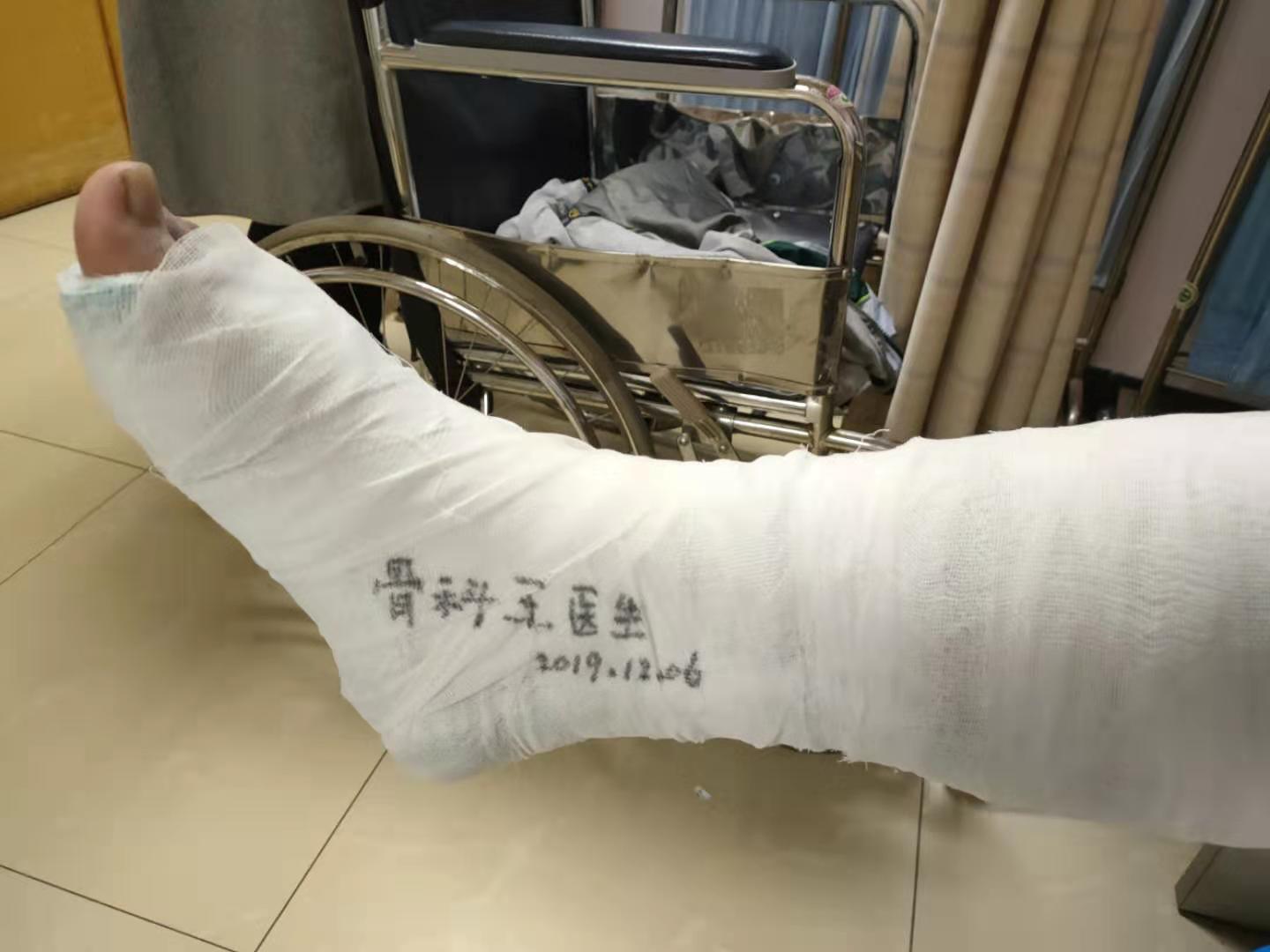 石膏能有效治疗骨折吗,石膏已经不固定骨折还会愈合吗