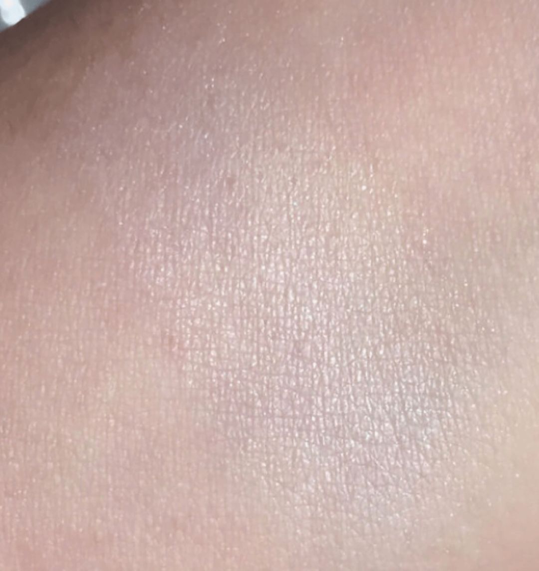 花10万打玻尿酸经验总结,花了将近十万打玻尿酸没有效果