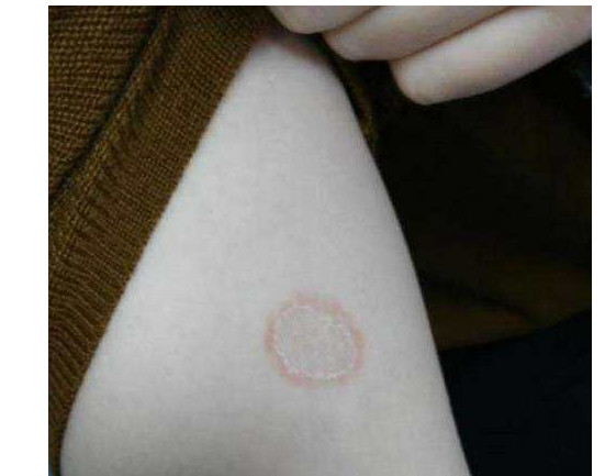 健康的猫不出门也会得猫瘟吗,完全不出门的猫会生病吗