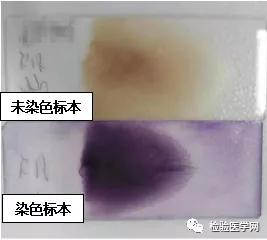 “秒”看血小板聚集，你get到了吗？