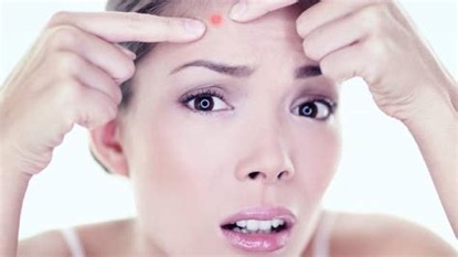 小痘痘的治疗方法,长痘不要惊慌教你自救小妙招