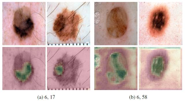 浅谈医学影像学习与实践,基于深度学习的医学影像研究思路