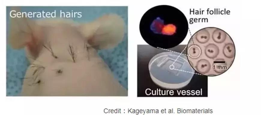 小孩喝完浑身长毛的这种“神药”,脱发的90后可否来一瓶?