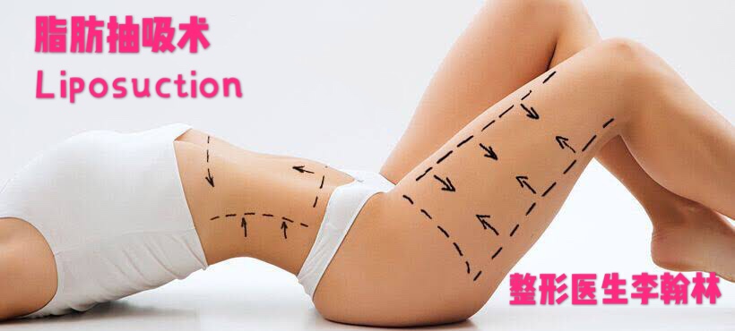 双下巴吸脂手术的危害,腹部吸脂手术有什么危害