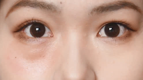 遮黑眼圈和泪沟具体方法和步骤,遮黑眼圈和泪沟的正确使用方法