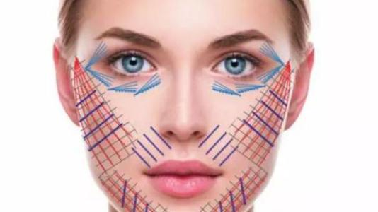 埋线提升,埋线提升需要几根线