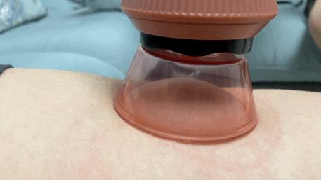 左点智能砭石走罐刮痧按摩器,左点砭石刮痧器效果怎么样