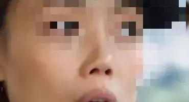 协和整形美容科专家,北京协和整形鼻综合