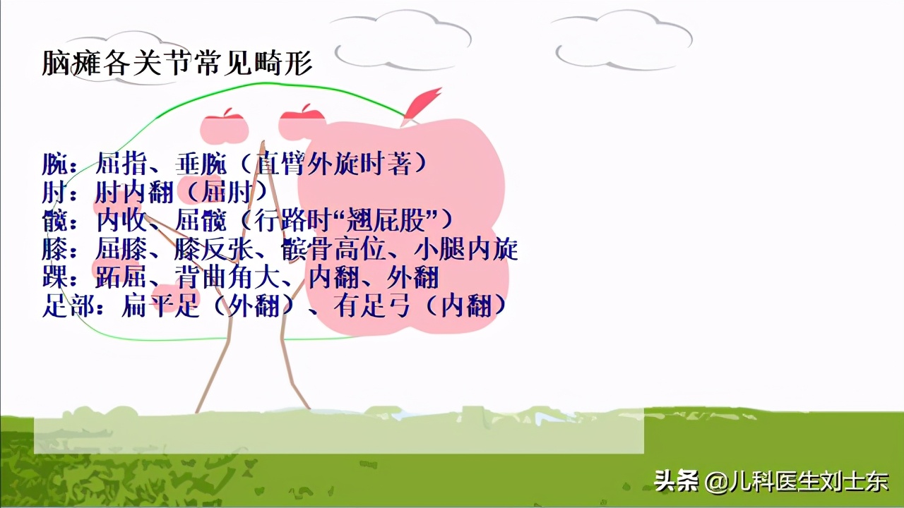 肉毒素治疗脑瘫患儿成功案例,肉毒素治疗脑瘫肌肉痉挛的效果