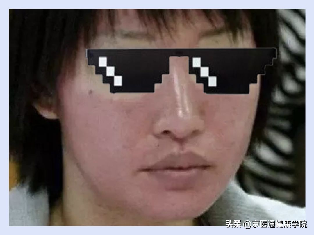 菲洛嘉适合过敏皮肤吗,菲洛嘉打了会过敏吗