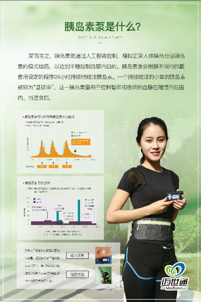 胰岛素泵各种品牌,胰岛素泵绝版了吗